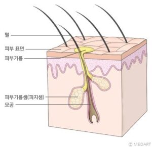 모공